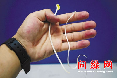 毒豆芽.jpg